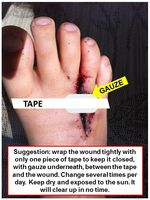 Foot